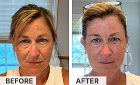 Jen sharing her experience with South Beach Collagen Filler Serum