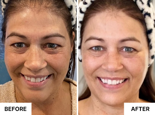 South Beach Collagen Filler Serum customer result image