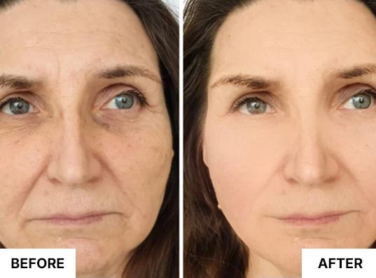 South Beach Collagen Filler Serum customer result image