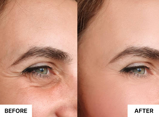 South Beach Collagen Filler Serum customer result image