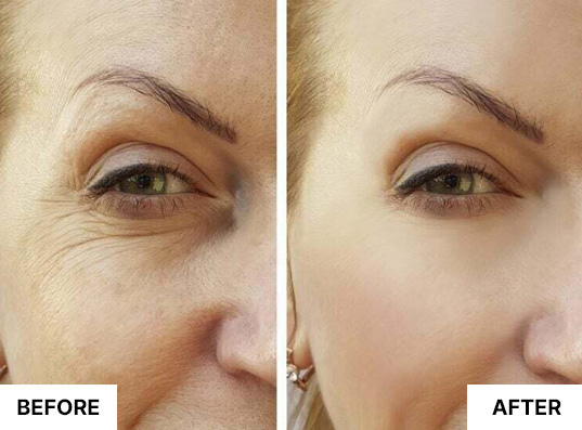 South Beach Collagen Filler Serum customer result image