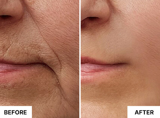 Customer before-and-after image featured by South Beach Skin Lab