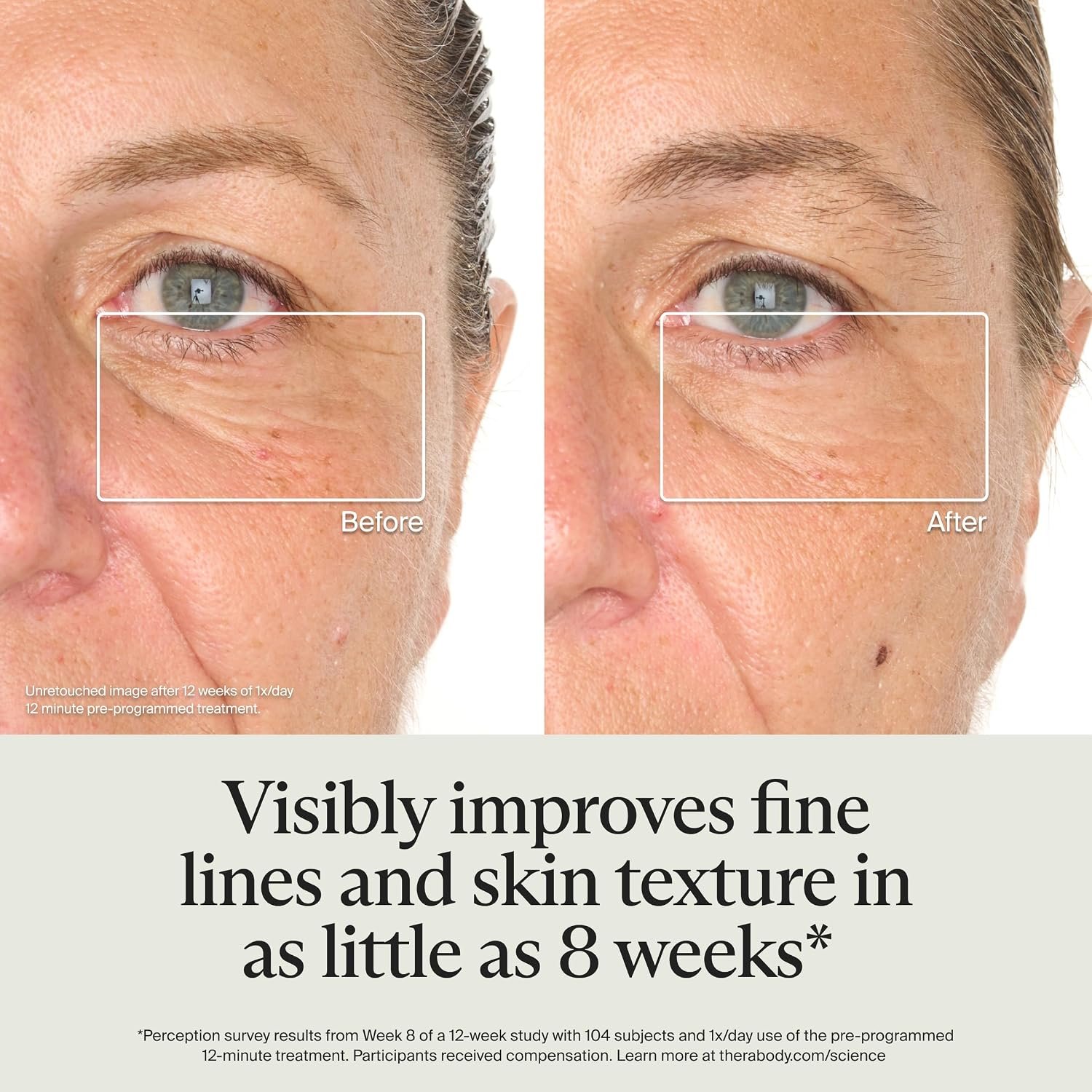 TheraFace Mask Glo brand before and after image